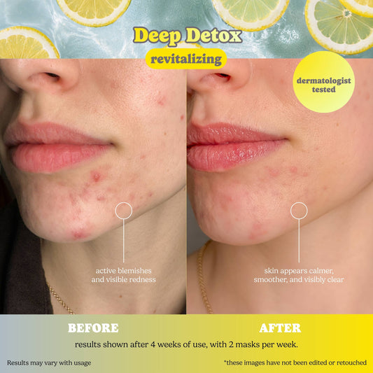 Deep Detox Pore Control Raw Juice Sheet Mask